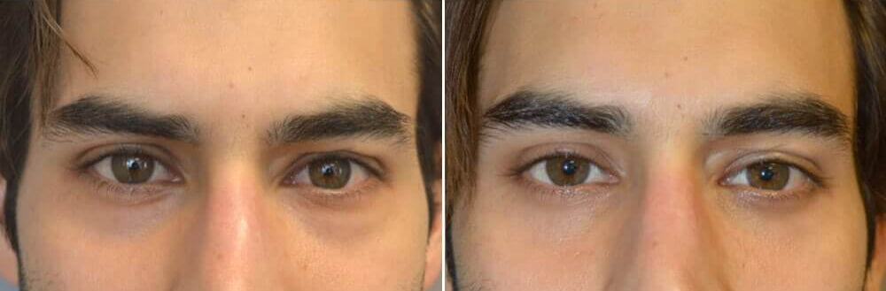 BOGO Caffeine & Rooibos Eye Cream