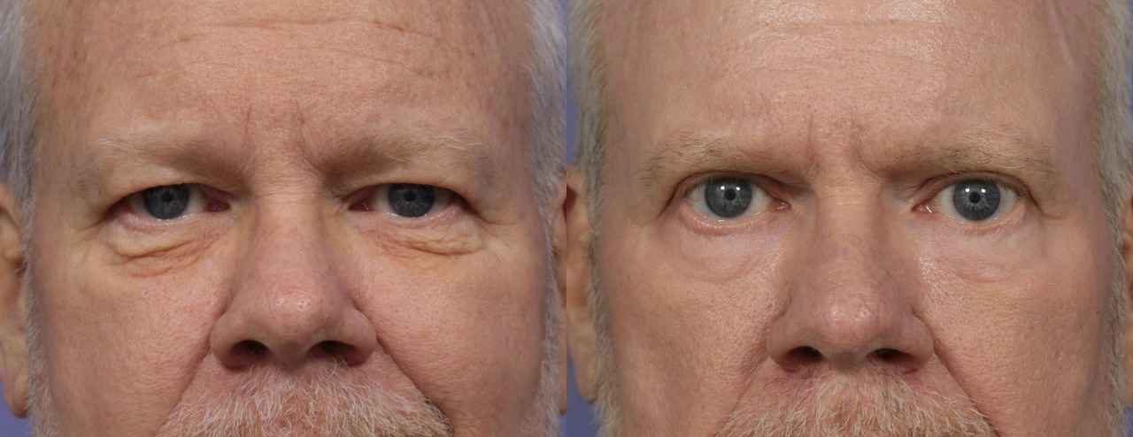 BOGO Caffeine & Rooibos Eye Cream