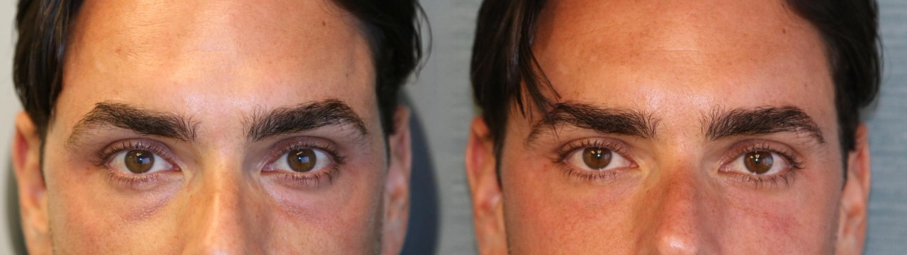 BOGO Caffeine & Rooibos Eye Cream