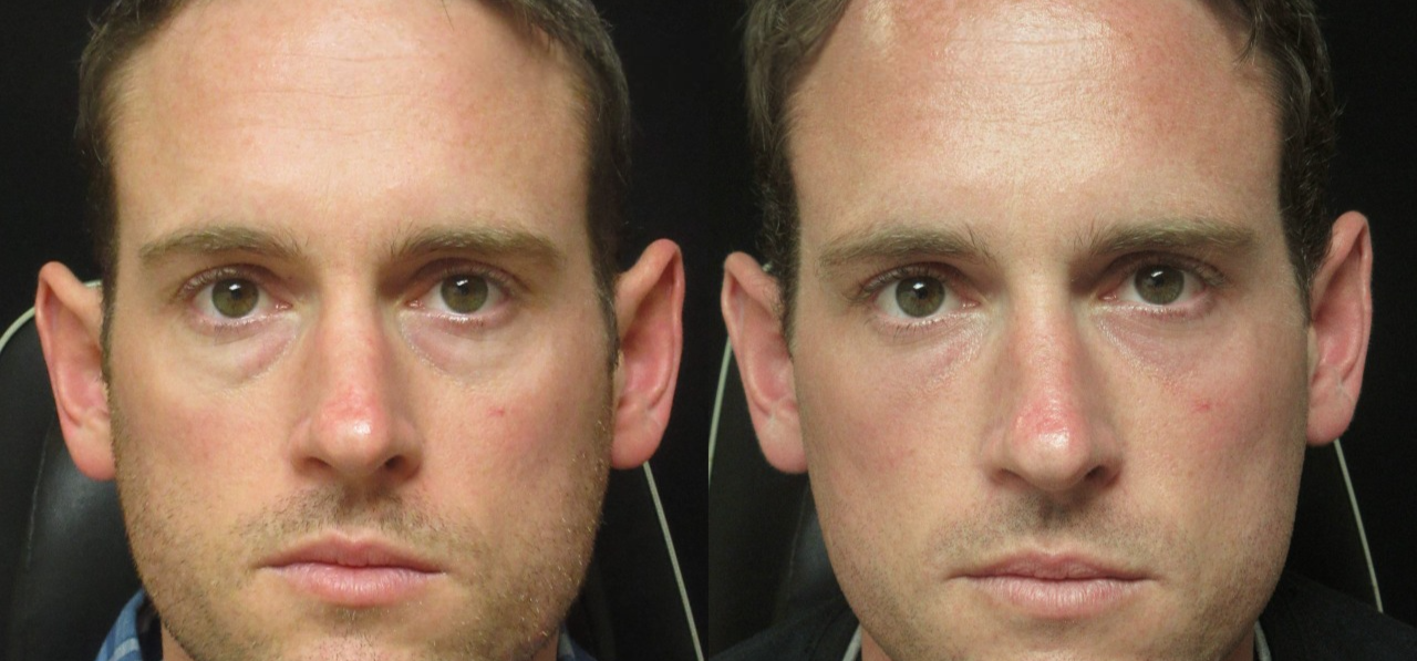 BOGO Caffeine & Rooibos Eye Cream