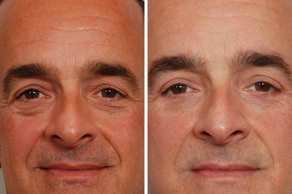 BOGO Caffeine & Rooibos Eye Cream