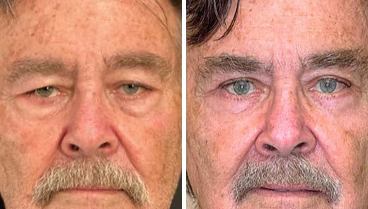 BOGO Caffeine & Rooibos Eye Cream